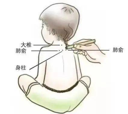 灸神阙穴