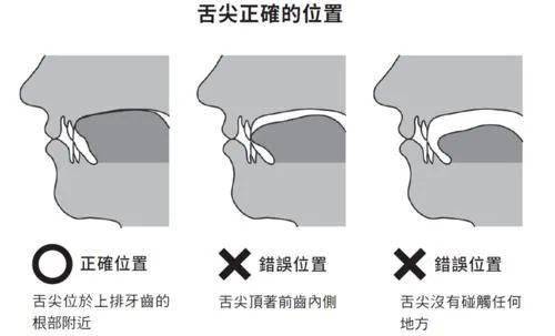 舌头正确的放松姿势是贴在上颚,舌尖在上排牙齿的后方,完全收纳在上颚