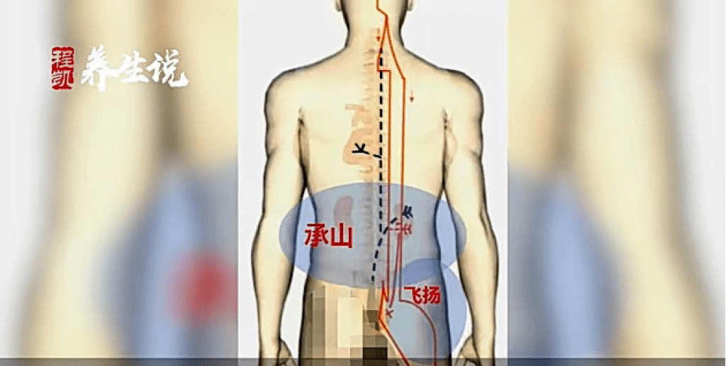 程凯养生说:腰痛,在小腿背侧的精准定位选穴