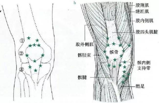 prp在膝骨关节炎oa的治疗及应用现况