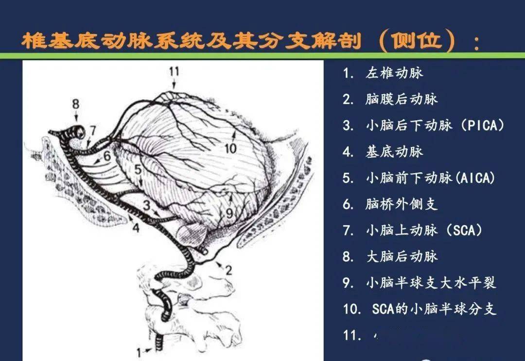 从梗死部位推测责任血管脑血管解剖