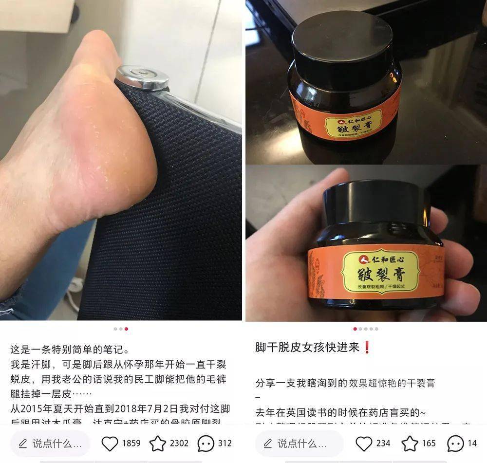 白天刮丝袜,晚上刮被子,让男友暖脚也被嫌弃!