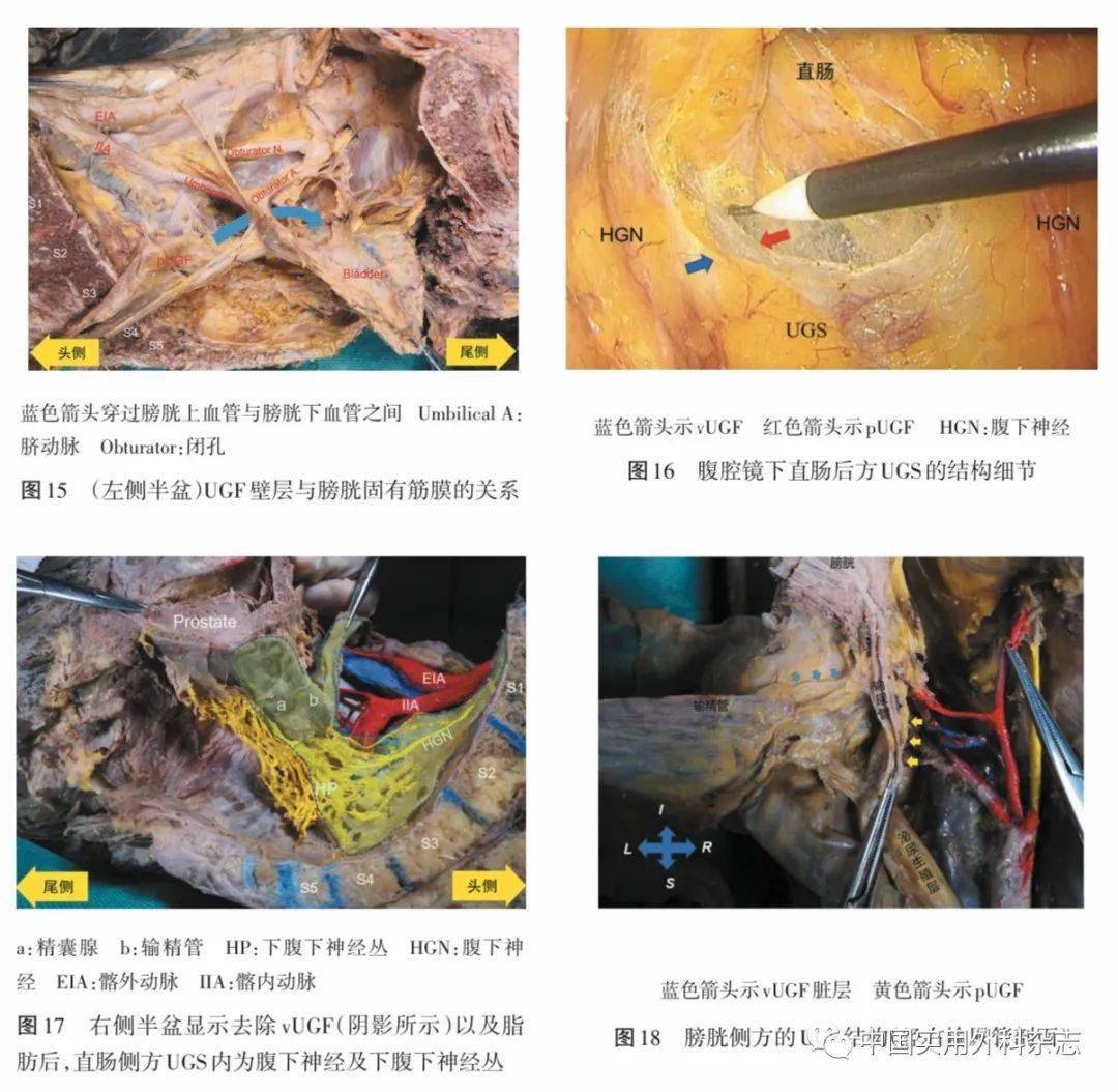 论著|男性泌尿生殖层的层面解剖及其临床意义研究