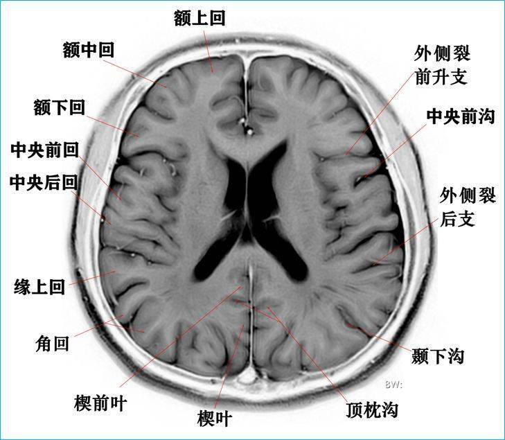 影像必备:高清颅脑mr断层解剖图谱