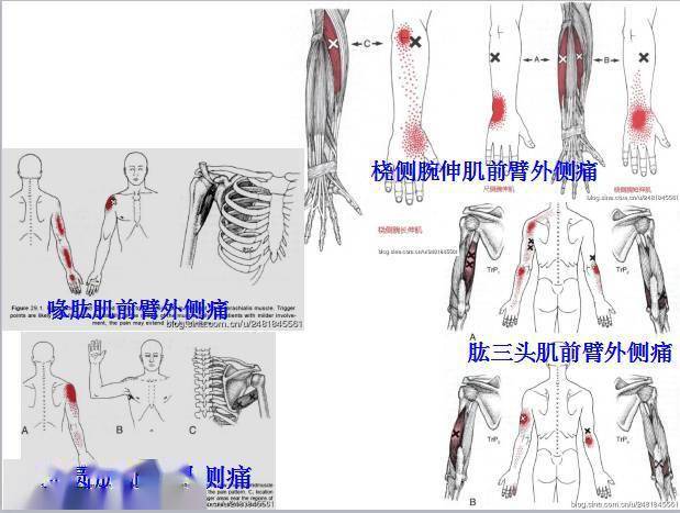 第四第五指伸肌(fourth and fifth finger extensors)  肘肌