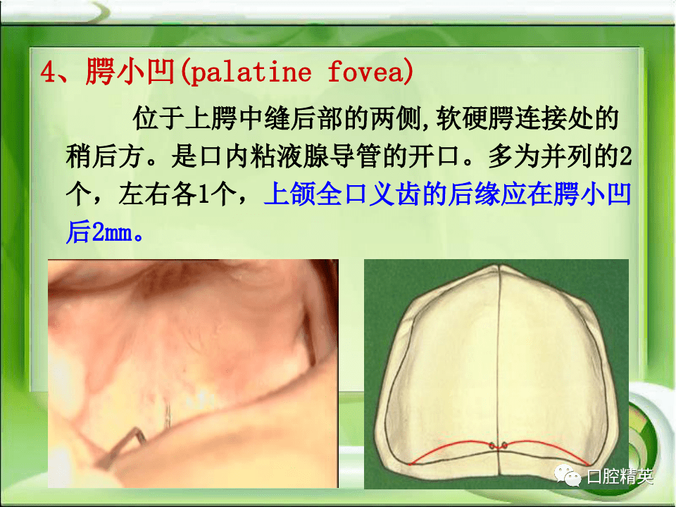 全口无牙颌解剖标志识别