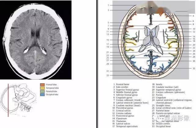 收藏史上最全的ct断层解剖图谱一篇所有都有