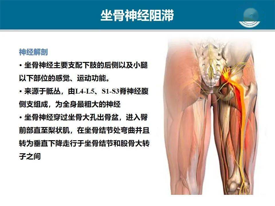 坐骨神经阻滞失败后,神经刺激仪引导的补充性腘窝坐骨