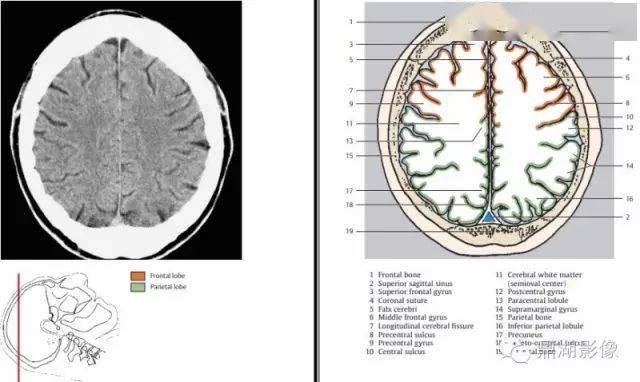收藏史上最全的ct断层解剖图谱一篇所有都有