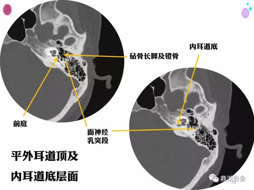 收藏史上最全的ct断层解剖图谱一篇所有都有