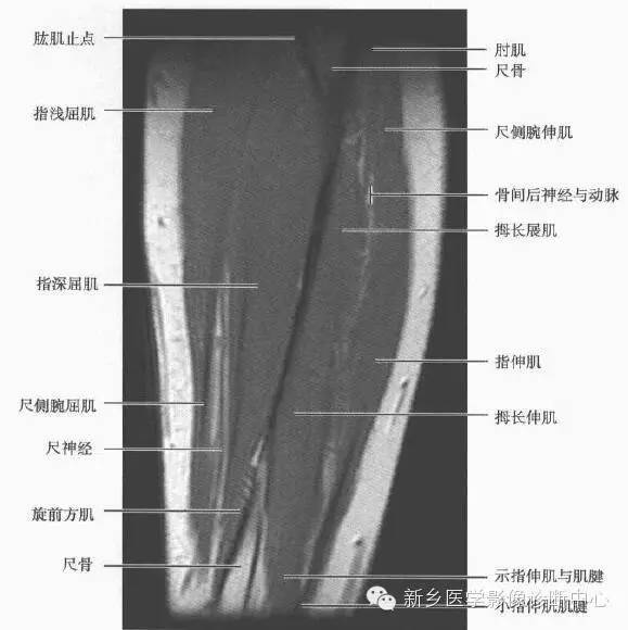 前臂精细mr断层解剖标注