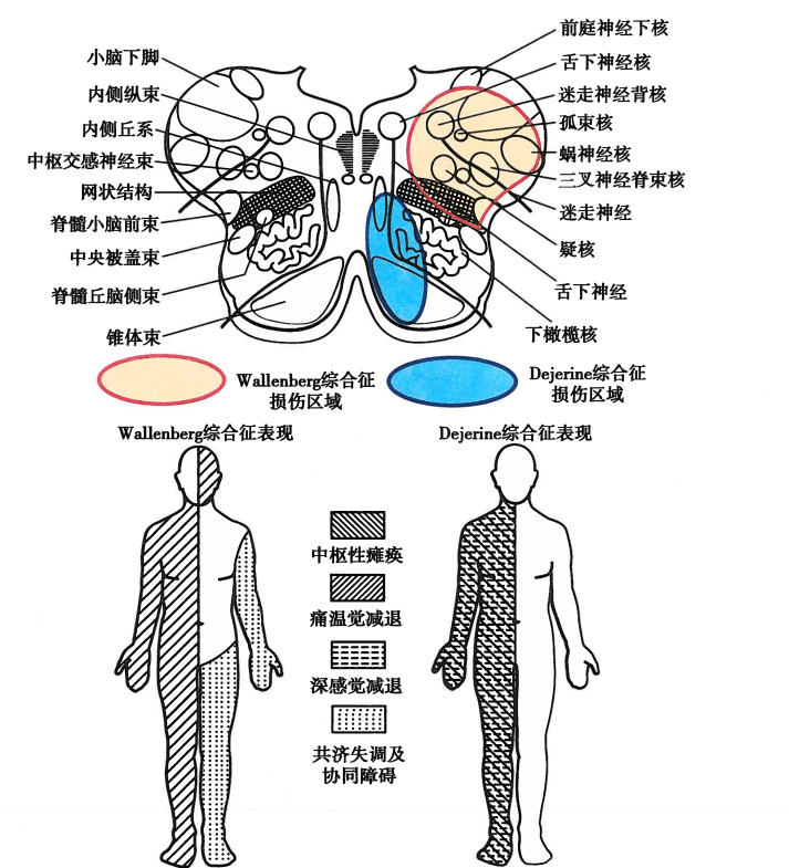 干货满满神经解剖学习脑干