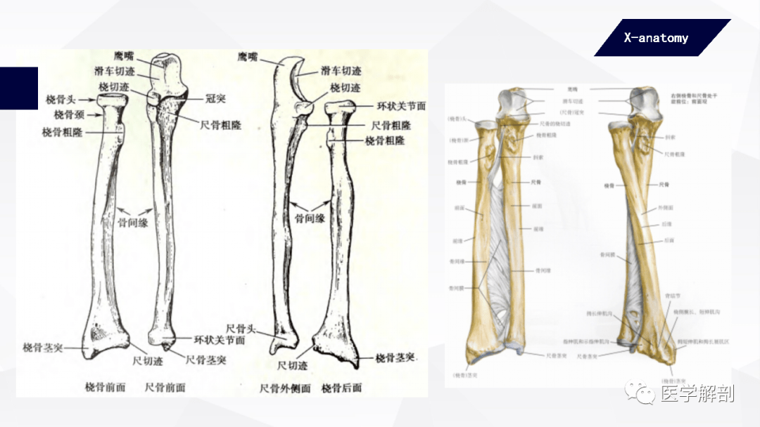 自由上肢骨借上肢带骨与躯干骨连接起来,因此,上肢能做游离于躯干的大