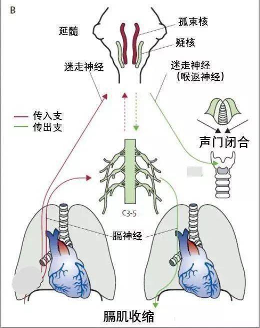 呃逆多因膈神经受到物理,化学因素的刺激所致,也可以由多种疾病如胃肠