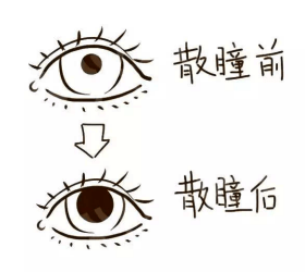 散瞳验光不可怕请不要盲目拒绝