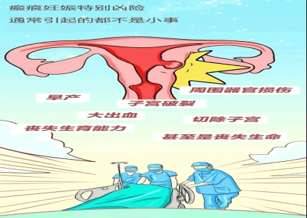 剖宫产疤痕妊娠二胎妈妈的大老虎
