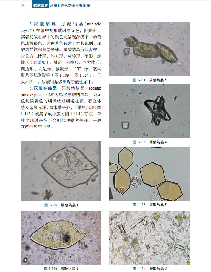 《临床体液及排泄物形态学检查图谱》第2版典型形态学