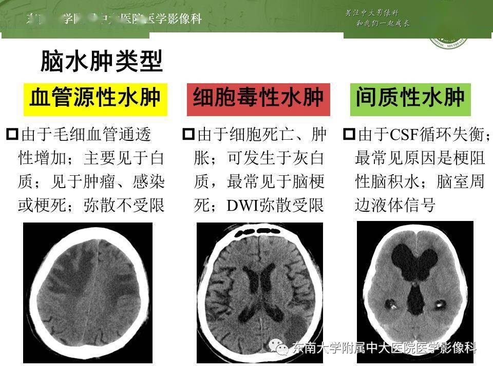 中枢神经系统血管源性水肿影像分析