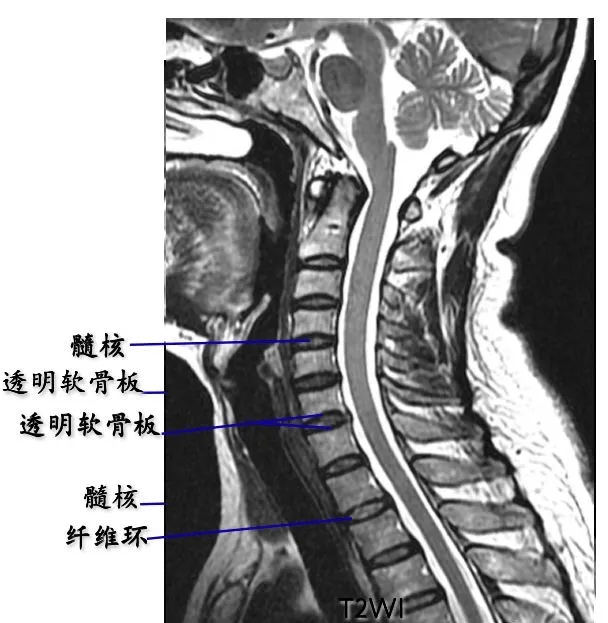 脊柱超详细解剖_颈椎