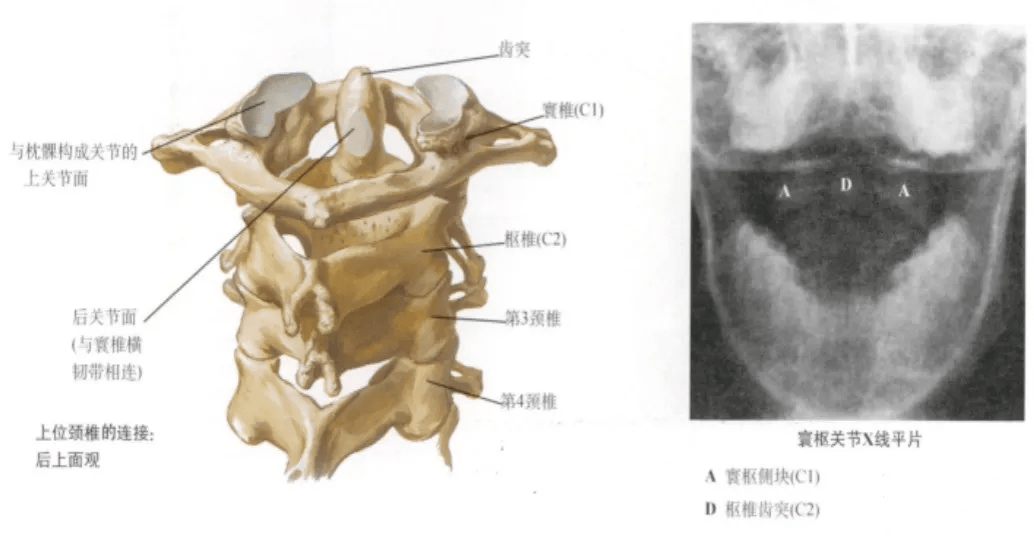棘突较短,末端分叉,第7颈椎棘突长,末端不分叉呈环状,无椎体寰椎:枢椎