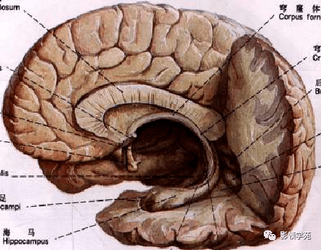 连接两侧大脑半球的白质纤维,分为胼胝体嘴,膝部,体部,压部 -中线处