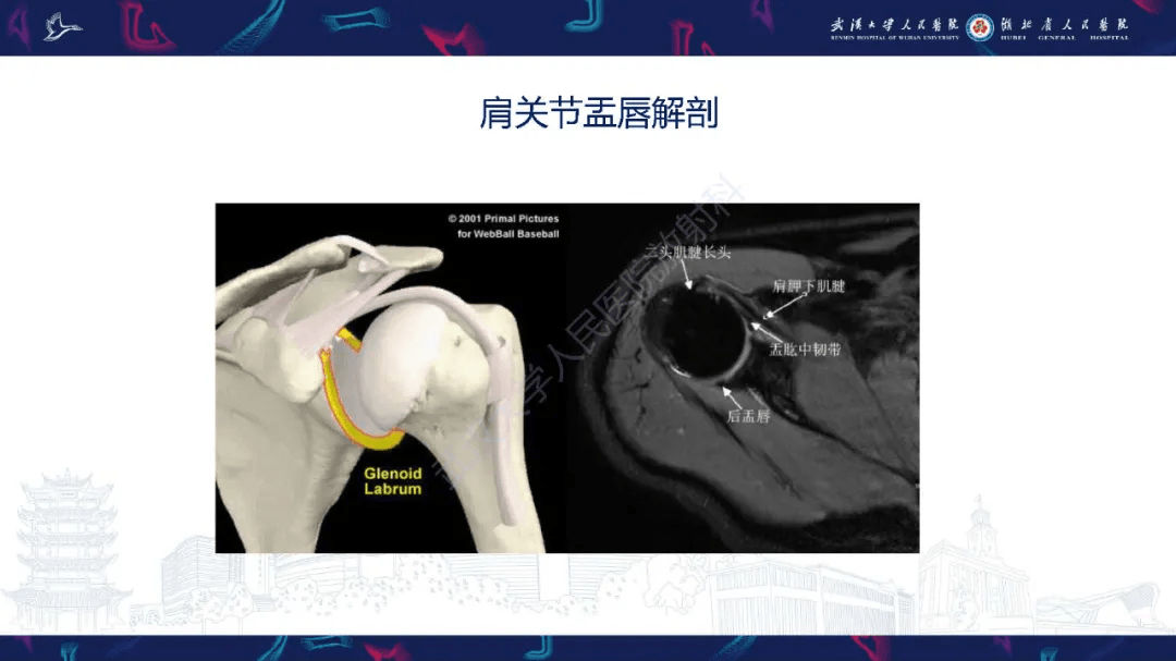 肩关节运动损伤mri诊断