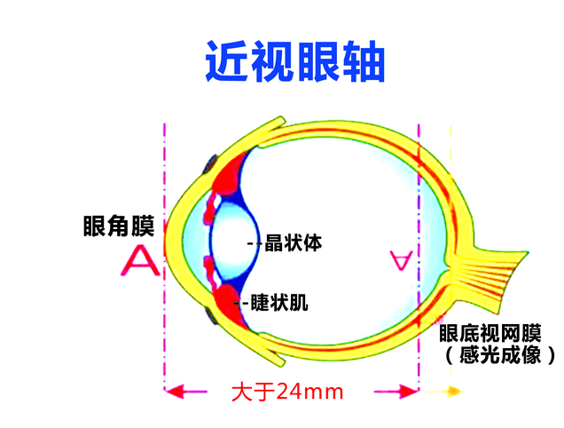 近视后经常眯眼看物体有什么危害?