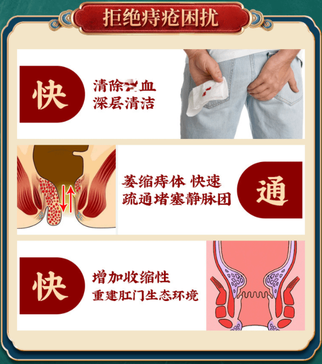 每天抹它,消肿止疼,不痒不便血