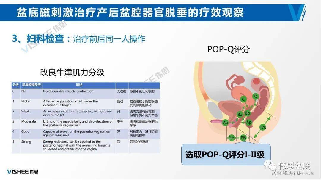 阴道突出肿物?别担心,磁刺激疗法来了