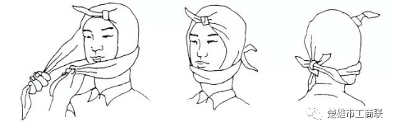 耳部风帽式包扎法 :将三角巾顶角打一个结,置于前额中央,头部套入风帽