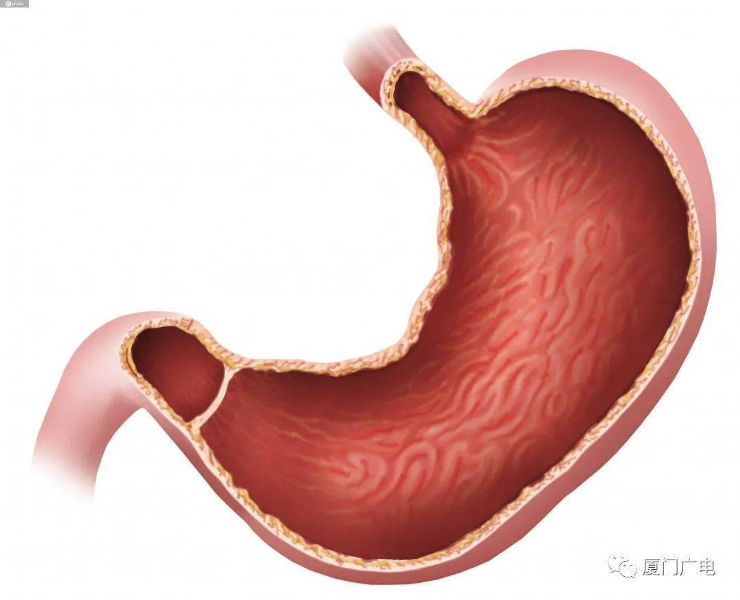 泉州一女恶心腹痛,一查胃里竟变成这样!这种病接吻也会传染