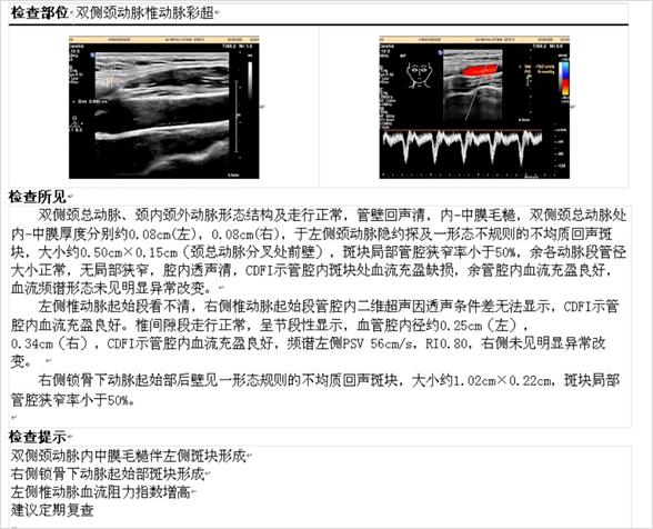 (图18)颈动脉彩超