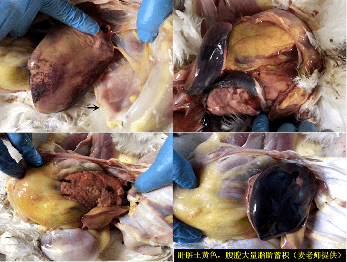 干货分享小心肝又破了鸡肝破裂病例的组织病理学观察与类病诊断