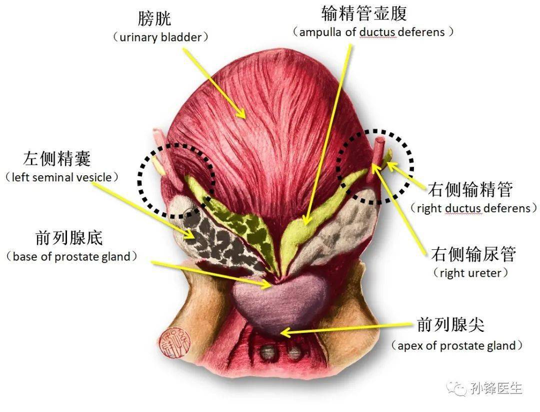 图(9):左侧输尿管与左侧输精管的交叉(黑色虚线圈)↑↑↑图(10):左侧