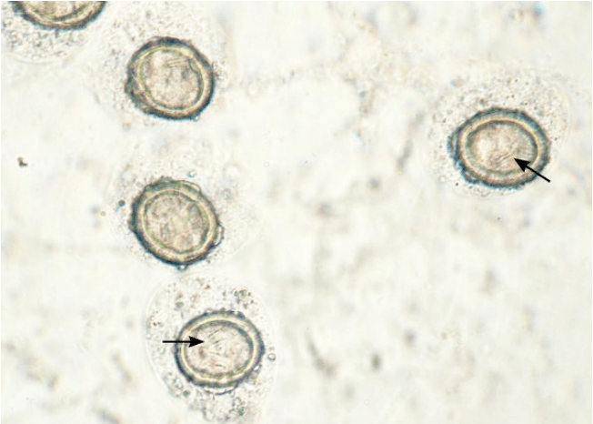 图8.26 犬粪便,100×物镜,犬复孔绦虫,可见虫卵中有小钩(箭头.