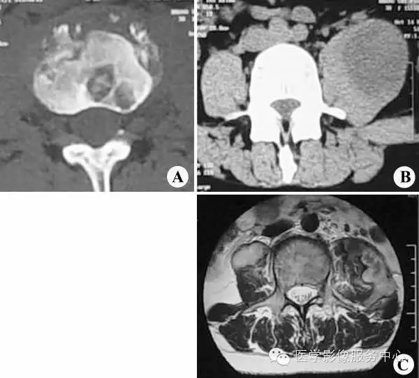 一文看懂 | 典型骨肌病例(x ct mr)