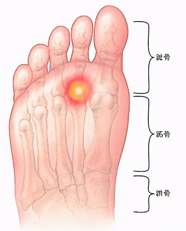 原来她患上.