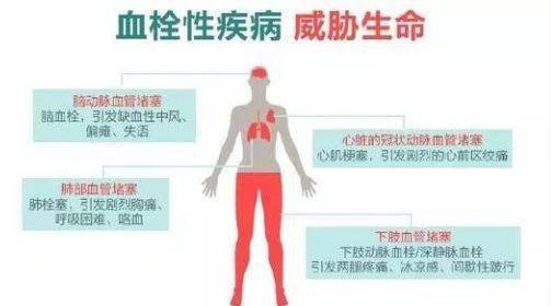 因此,预防血栓就显得尤为重要.