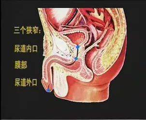 2 男性尿道的特点 男性成人尿道长,弯,细,长18～20cm 三个狭窄:尿道