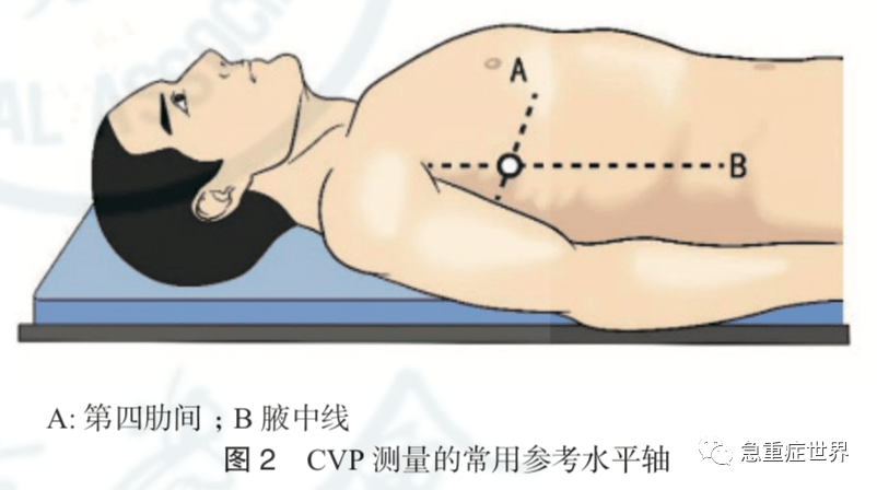 中心静脉压急诊临床应用中国专家共识(2020版)