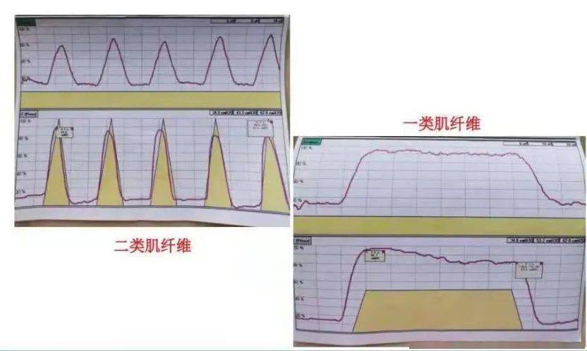 在进行一系列收缩和放松运动中,直观地评估盆底慢肌和快肌的功能状态