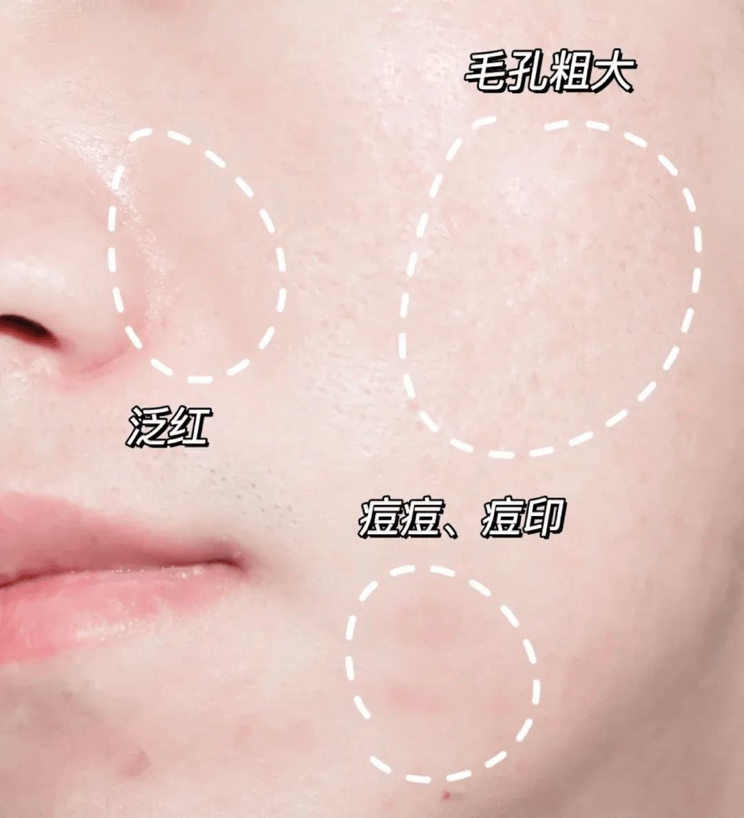 油脂|油皮高质量护肤怎么做？这份清单收好了