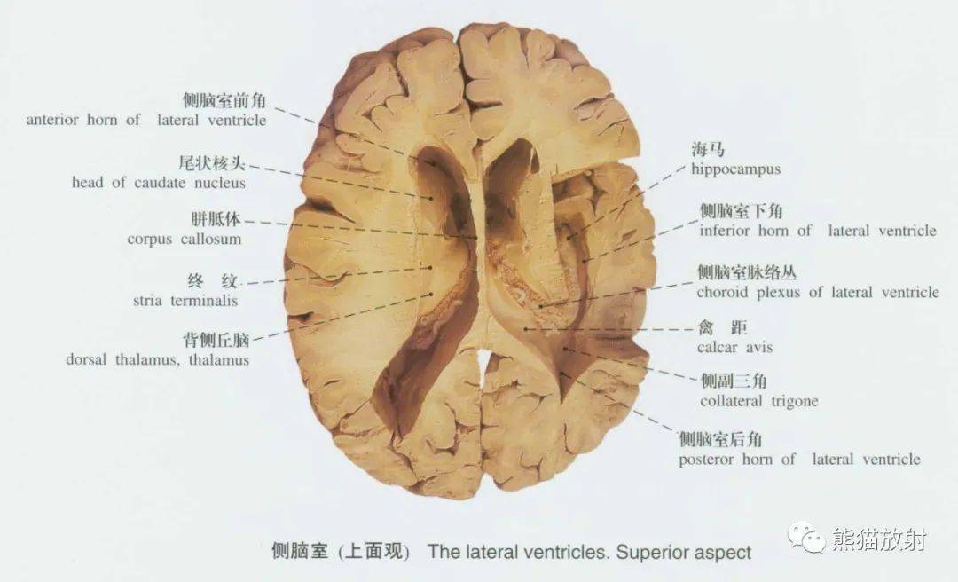 系统解剖标本图谱丨脊髓,脑