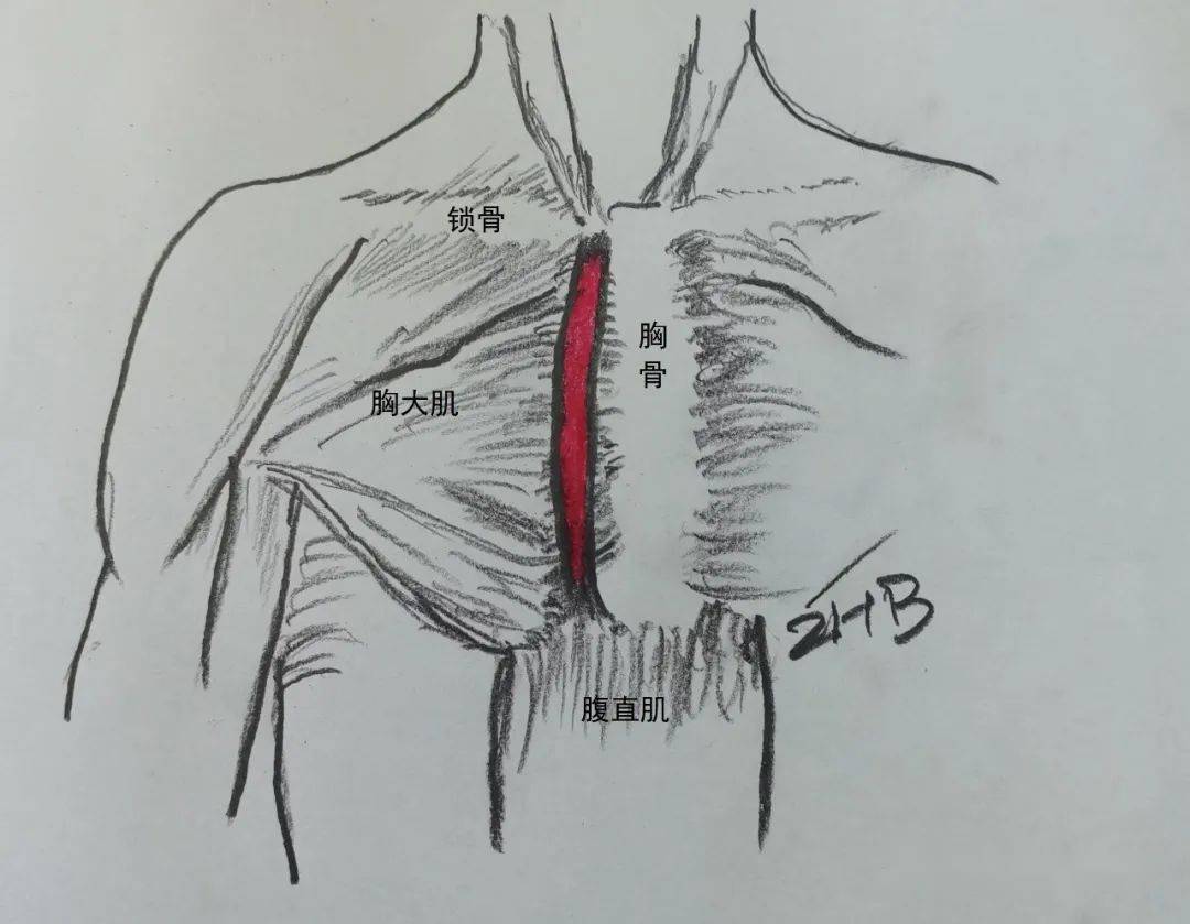 超声解剖副肌:胸骨肌