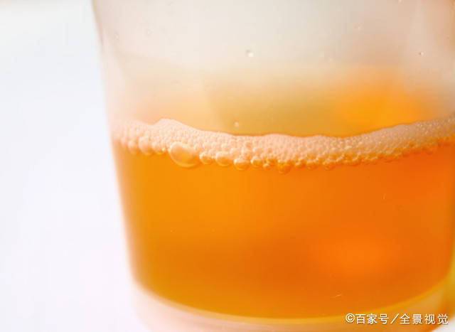 肝脏|乙肝多久复查一次?提醒肝病朋友,身体出现3种异常,及时检查