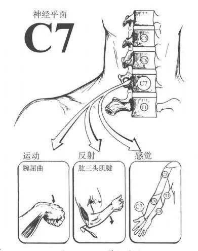 肱三头肌:c7(桡神经)