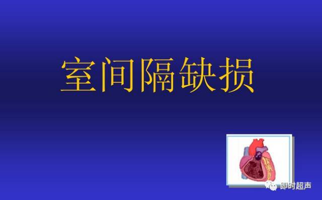 6种小儿常见先天性心脏病超声表现