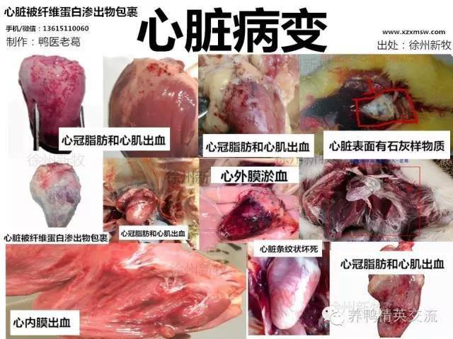 鸭中暑:心外膜淤血鸭痛风:心脏表面有石灰样物质大肠杆菌病:心脏被