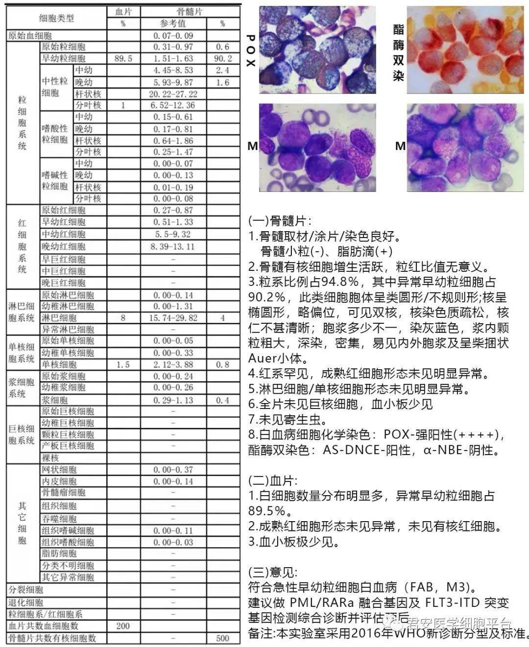 外周血涂片:白细胞总数增高,可见大量异常早幼粒细胞,建议骨髓穿刺