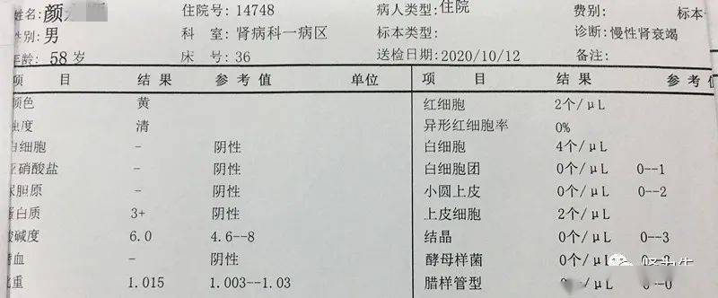 尿蛋白分析